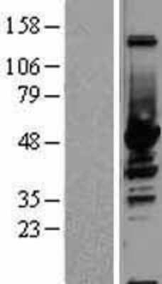 Western Blot: Enolase 1 Overexpression Lysate [NBL1-10267]