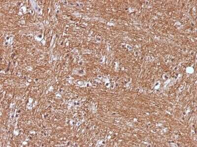 Immunohistochemistry-Paraffin: Enolase 2/Neuron-specific Enolase Antibody (ENO2/1375) - Azide and BSA Free [NBP2-54452]