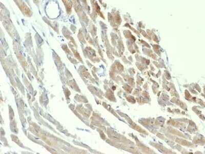 Immunohistochemistry-Paraffin: Enolase 2/Neuron-specific Enolase Antibody (ENO2/1375) - Azide and BSA Free [NBP2-54452]
