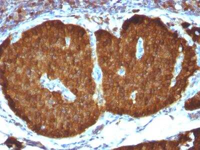 Immunohistochemistry-Paraffin: Enolase 2/Neuron-specific Enolase Antibody (ENO2/1375) [NBP2-47635]