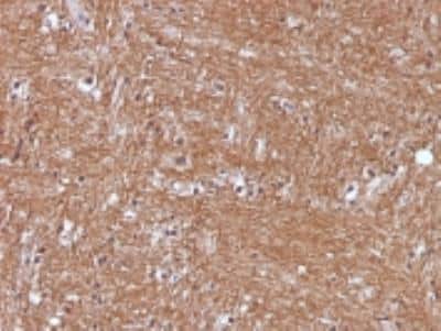 Immunohistochemistry-Paraffin: Enolase 2/Neuron-specific Enolase Antibody (ENO2/1375) [NBP2-47635]