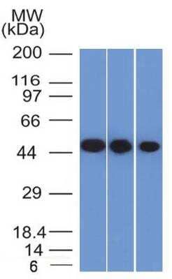 Western Blot: Enolase 2/Neuron-specific Enolase Antibody (ENO2/1375) [NBP2-47635]