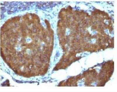 Immunohistochemistry-Paraffin: Enolase 2/Neuron-specific Enolase Antibody (ENO2/1462) - Azide and BSA Free [NBP2-59603]