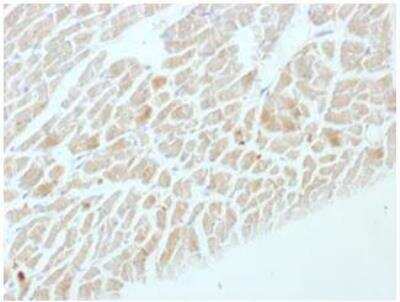 Immunohistochemistry-Paraffin: Enolase 2/Neuron-specific Enolase Antibody (ENO2/1462) [NBP2-59602]