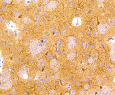 Immunohistochemistry-Paraffin: Enolase 2/Neuron-specific Enolase Antibody (SC06-28) [NBP2-67641]