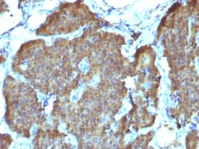 Immunohistochemistry-Paraffin: Enolase 2/Neuron-specific Enolase Antibody (SPM347) - Azide and BSA Free [NBP2-54590]