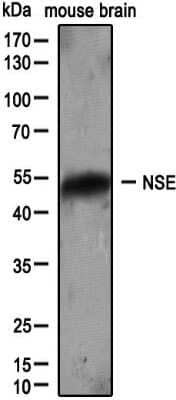 Western Blot: Enolase 2/Neuron-specific Enolase Antibody [NB110-58870]