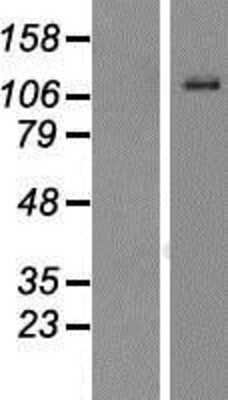 Western Blot: Enteropeptidase/Enterokinase Overexpression Lysate [NBP2-10849]