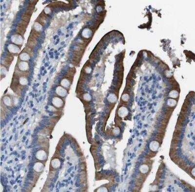 Immunohistochemistry-Paraffin: Enteropeptidase/Enterokinase Antibody [NBP1-87949]