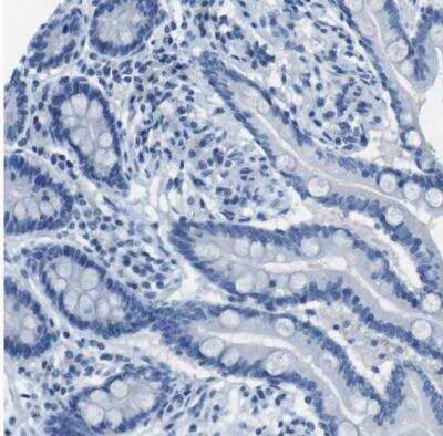 Immunohistochemistry-Paraffin: Enteropeptidase/Enterokinase Antibody [NBP1-87949]