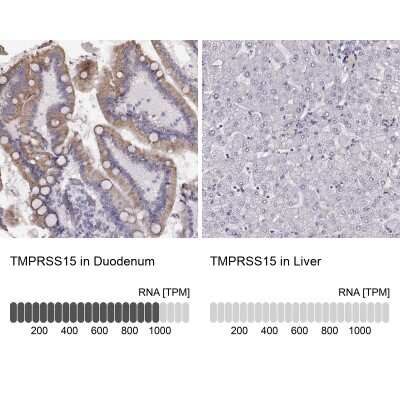 Immunohistochemistry-Paraffin: Enteropeptidase/Enterokinase Antibody [NBP2-62679]