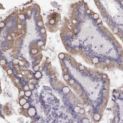 Immunohistochemistry-Paraffin: Enteropeptidase/Enterokinase Antibody [NBP2-62679]