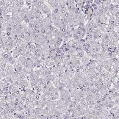 Immunohistochemistry-Paraffin: Enteropeptidase/Enterokinase Antibody [NBP2-62679]
