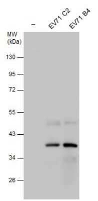 Western Blot: Enterovirus 71 2C Antibody [NBP3-13095]