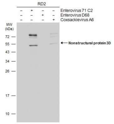 Western Blot: Enterovirus 71 3D Antibody (4) [NBP3-13502]