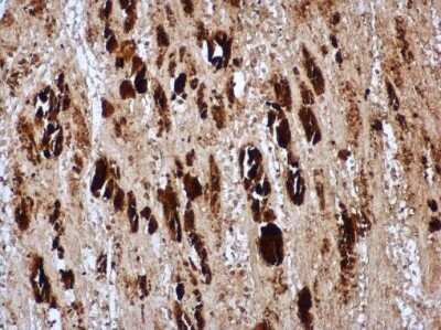 Immunohistochemistry-Paraffin: Enterovirus 71 VP1 Antibody [NBP3-13086]