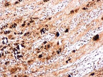 Immunohistochemistry-Paraffin: Enterovirus 71 VP1 Antibody [NBP3-13087]