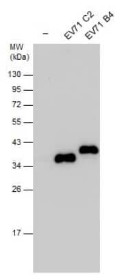 Western Blot: Enterovirus 71 VP1 Antibody [NBP3-13117]