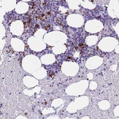 Immunohistochemistry-Paraffin: Eosinophil derived neurotoxin Antibody [NBP1-91872]
