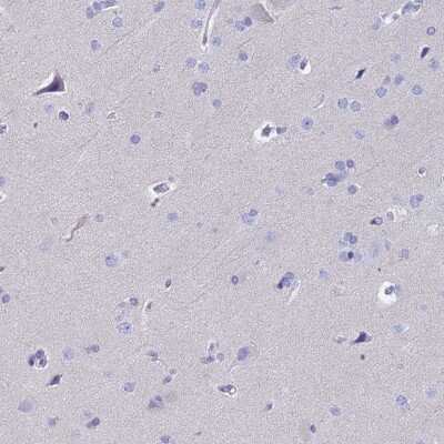 Immunohistochemistry-Paraffin: Eosinophil derived neurotoxin Antibody [NBP1-91872]