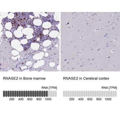 Immunohistochemistry-Paraffin: Eosinophil derived neurotoxin Antibody [NBP1-91872]