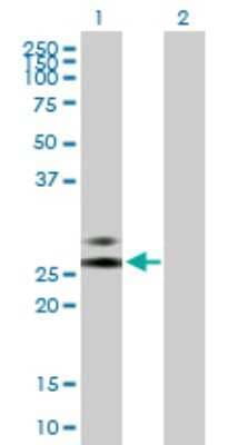 Western Blot: Eosinophil derived neurotoxin Antibody [H00006036-B01P]