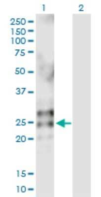 Western Blot: Eosinophil derived neurotoxin Antibody [H00006036-D01P]