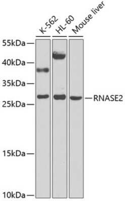 Western Blot: Eosinophil derived neurotoxin AntibodyBSA Free [NBP3-03635]