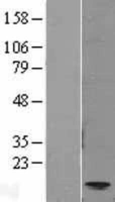 Western Blot: CCL11/Eotaxin Overexpression Lysate [NBL1-08842]