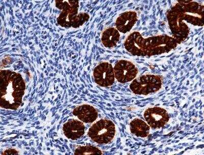 Immunohistochemistry-Paraffin: EpCAM/TROP1 Antibody (002) [NBP2-89589]