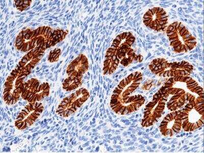 Immunohistochemistry-Paraffin: EpCAM/TROP1 Antibody (065) [NBP2-90654]