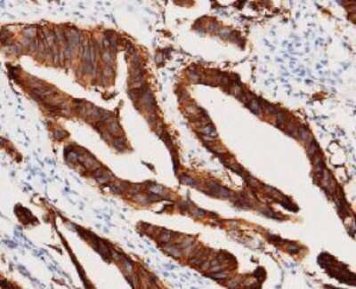 Immunohistochemistry-Paraffin: EpCAM/TROP1 Antibody (28) [NBP2-89605]