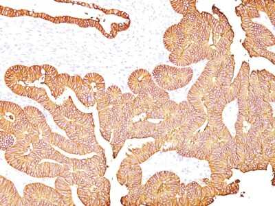 Immunohistochemistry-Paraffin: EpCAM/TROP1 Antibody (323/A3) - (ECD) [NBP2-34274]