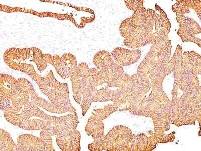 Immunohistochemistry-Paraffin: EpCAM/TROP1 Antibody (323/A3) - (ECD) - IHC-Prediluted [NBP2-44642]