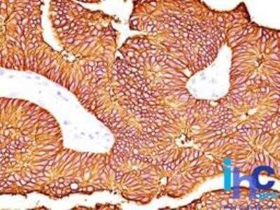 Immunohistochemistry: EpCAM/TROP1 Antibody (60N5D8) - Azide and BSA Free [NBP2-80722]
