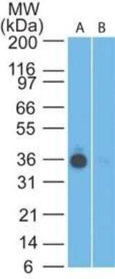 Western Blot: EpCAM/TROP1 Antibody (60N5D8)BSA Free [NBP2-22381]