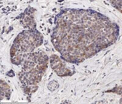 Immunohistochemistry: EpCAM/TROP1 Antibody (AUA1) - Azide and BSA Free [NBP2-80721]
