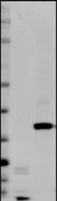 Western Blot: EpCAM/TROP1 Antibody (AUA1)Azide and BSA Free [NBP2-80721]