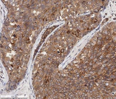 Immunohistochemistry-Paraffin: EpCAM/TROP1 Antibody (AUA1) - BSA Free [NB600-1182]