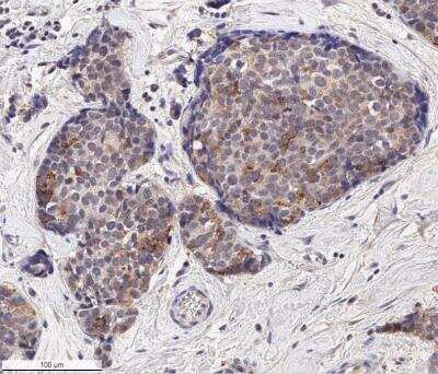 Immunohistochemistry-Paraffin: EpCAM/TROP1 Antibody (AUA1) - BSA Free [NB600-1182]