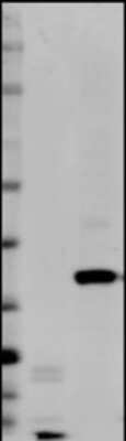 Western Blot: EpCAM/TROP1 Antibody (AUA1)BSA Free [NB600-1182]