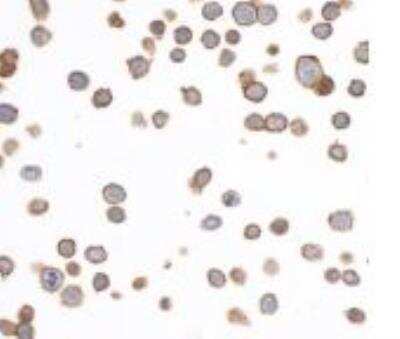 Immunocytochemistry/ Immunofluorescence: EpCAM/TROP1 Antibody (BLR077G) [NBP3-14685]