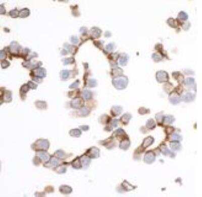 Immunocytochemistry/ Immunofluorescence: EpCAM/TROP1 Antibody (BLR077G) [NBP3-14685]