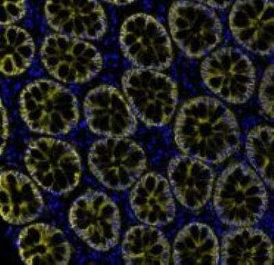 Immunohistochemistry-Paraffin: EpCAM/TROP1 Antibody (BLR077G) [NBP3-14685]