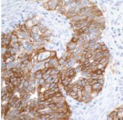 Immunohistochemistry-Paraffin: EpCAM/TROP1 Antibody (BLR077G) [NBP3-14685]