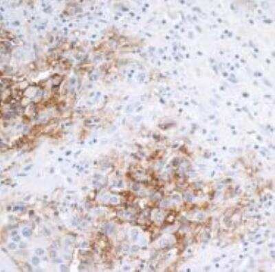 Immunohistochemistry-Paraffin: EpCAM/TROP1 Antibody (BLR077G) [NBP3-14685]