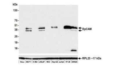 Western Blot: EpCAM/TROP1 Antibody (BLR077G) [NBP3-14685]