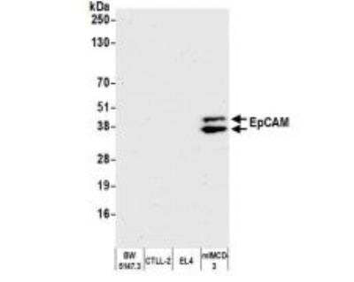 Western Blot: EpCAM/TROP1 Antibody (BLR077G) [NBP3-14685]