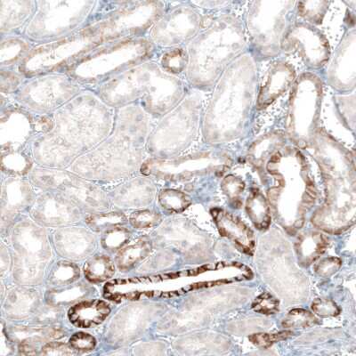 Immunohistochemistry-Paraffin: EpCAM/TROP1 Antibody (CL6259) [NBP2-76485]