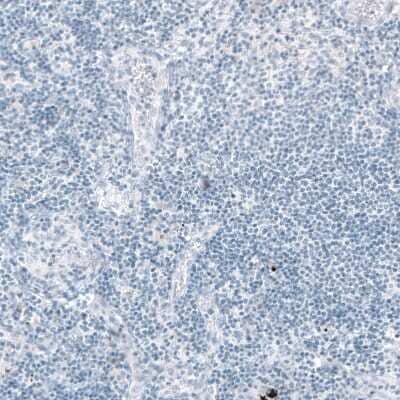 Immunohistochemistry-Paraffin: EpCAM/TROP1 Antibody (CL6259) [NBP2-76485]